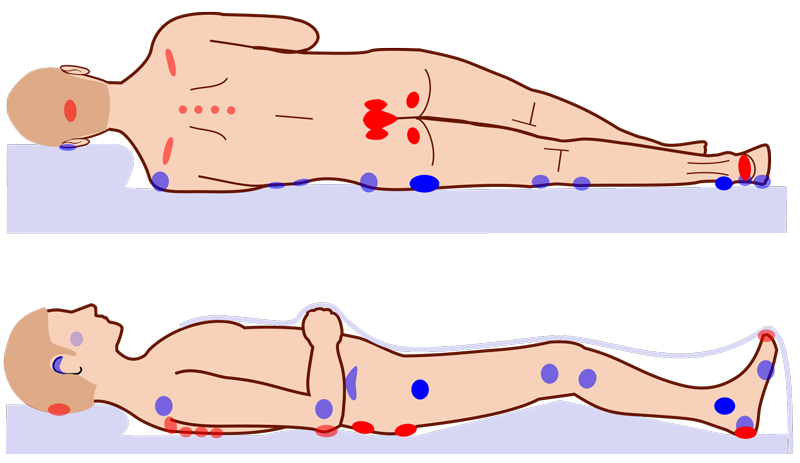 Supine position - Wikipedia