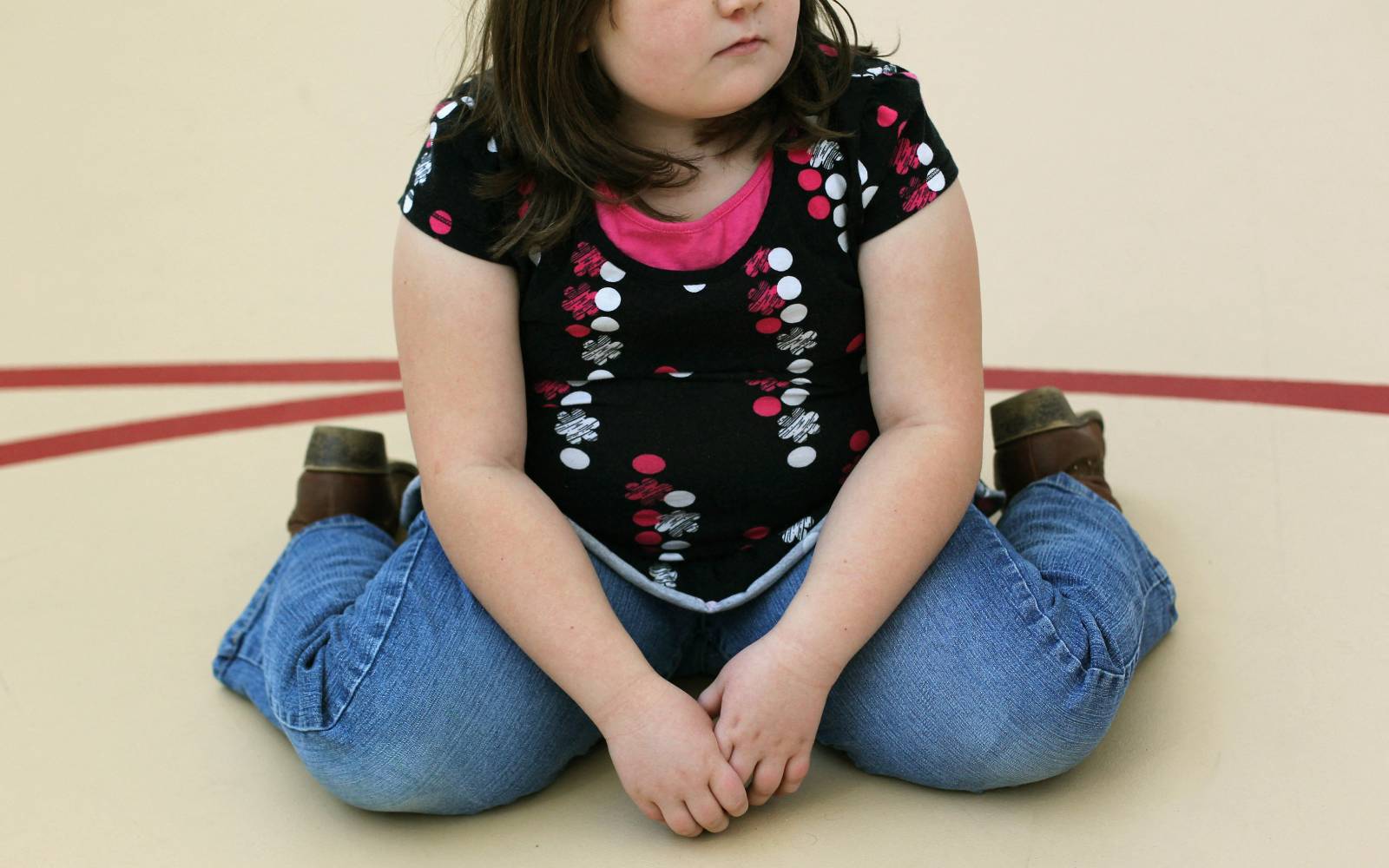 Obese